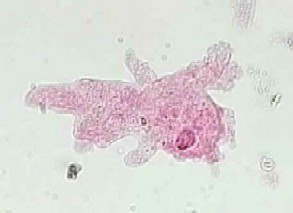 amoeba_proteus_X_100.jpg